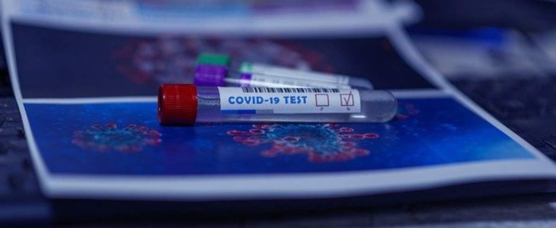 Test na koronawirusa na Słowacji