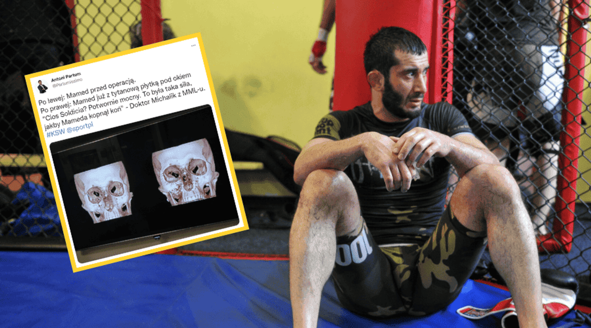 Mamed Khalidov operacja Roberto Soldić KSW 65