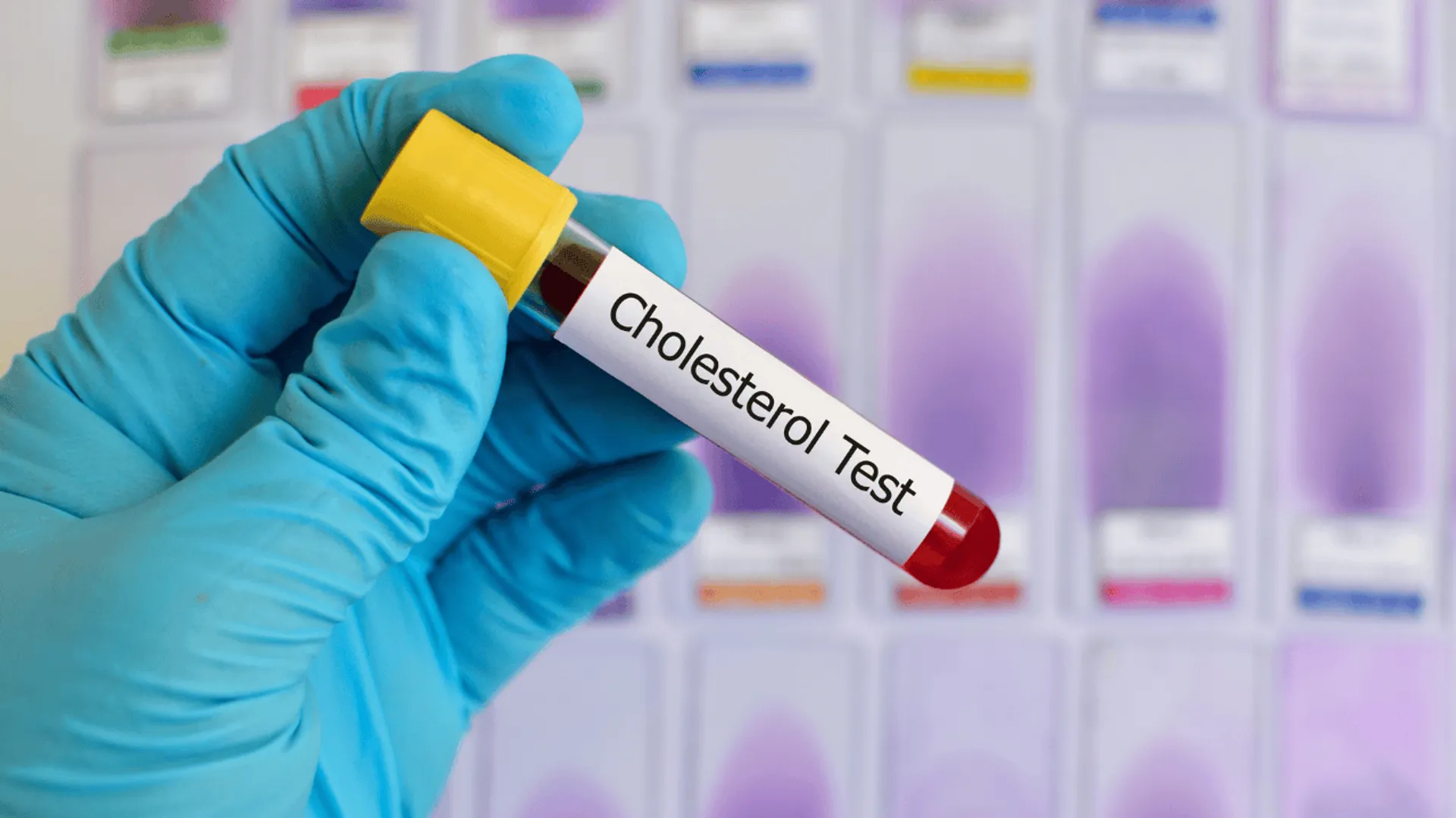 Cholesterol test