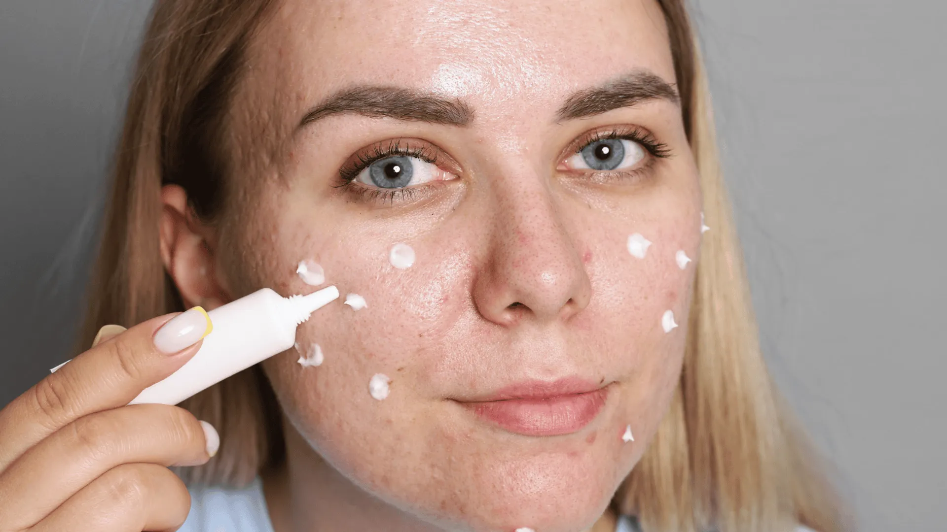 iastkujący się podkład, uczucie ściągnięcia i łuszczenie skóry