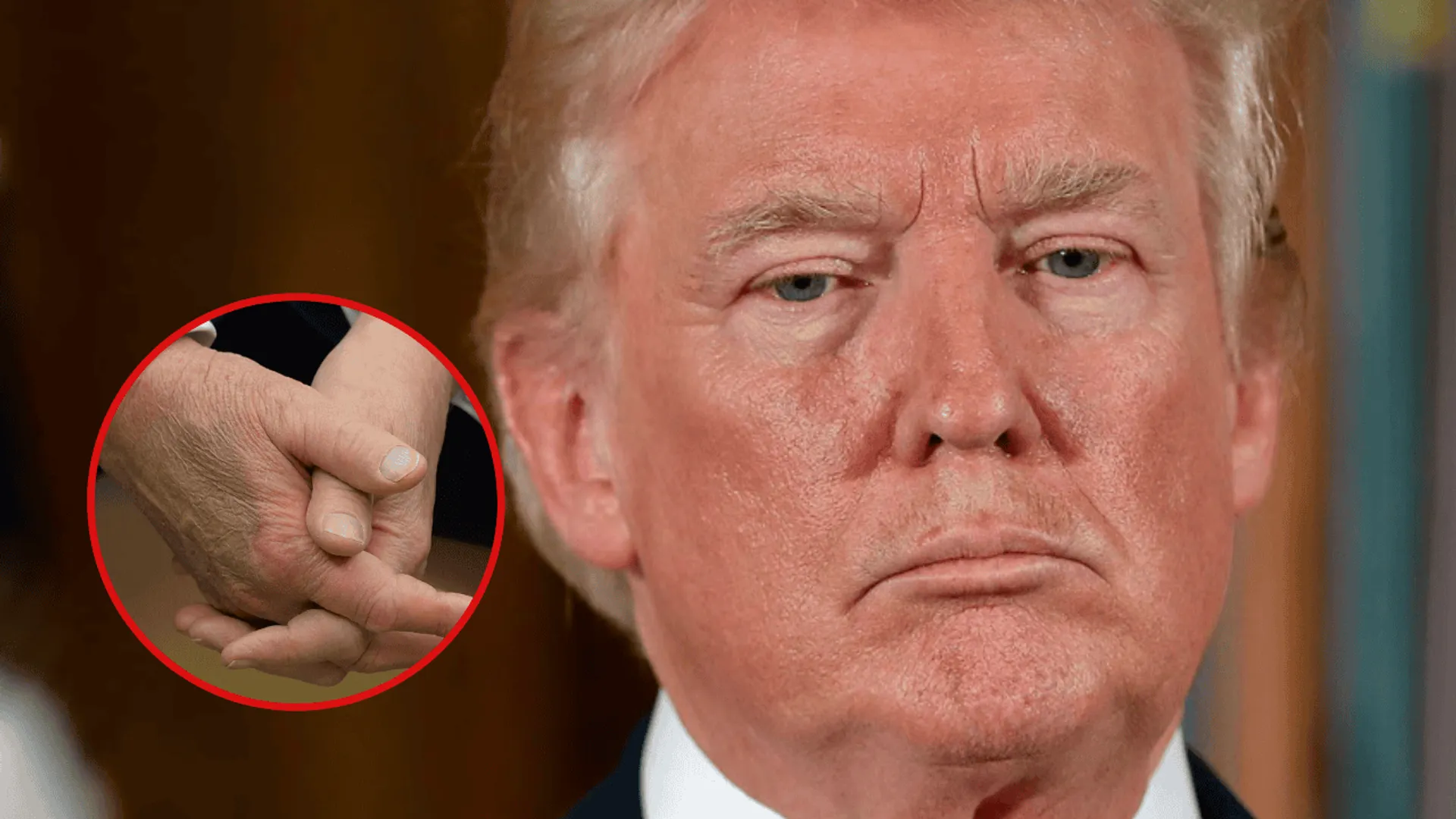 Donald Trump choroba