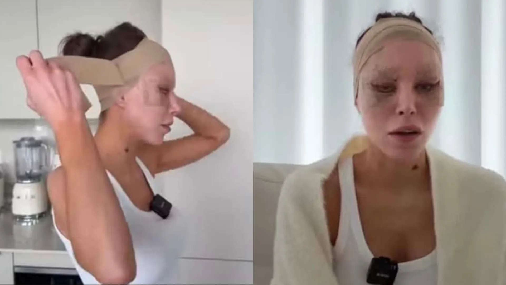 Julia Von Stein po 2 operacji
