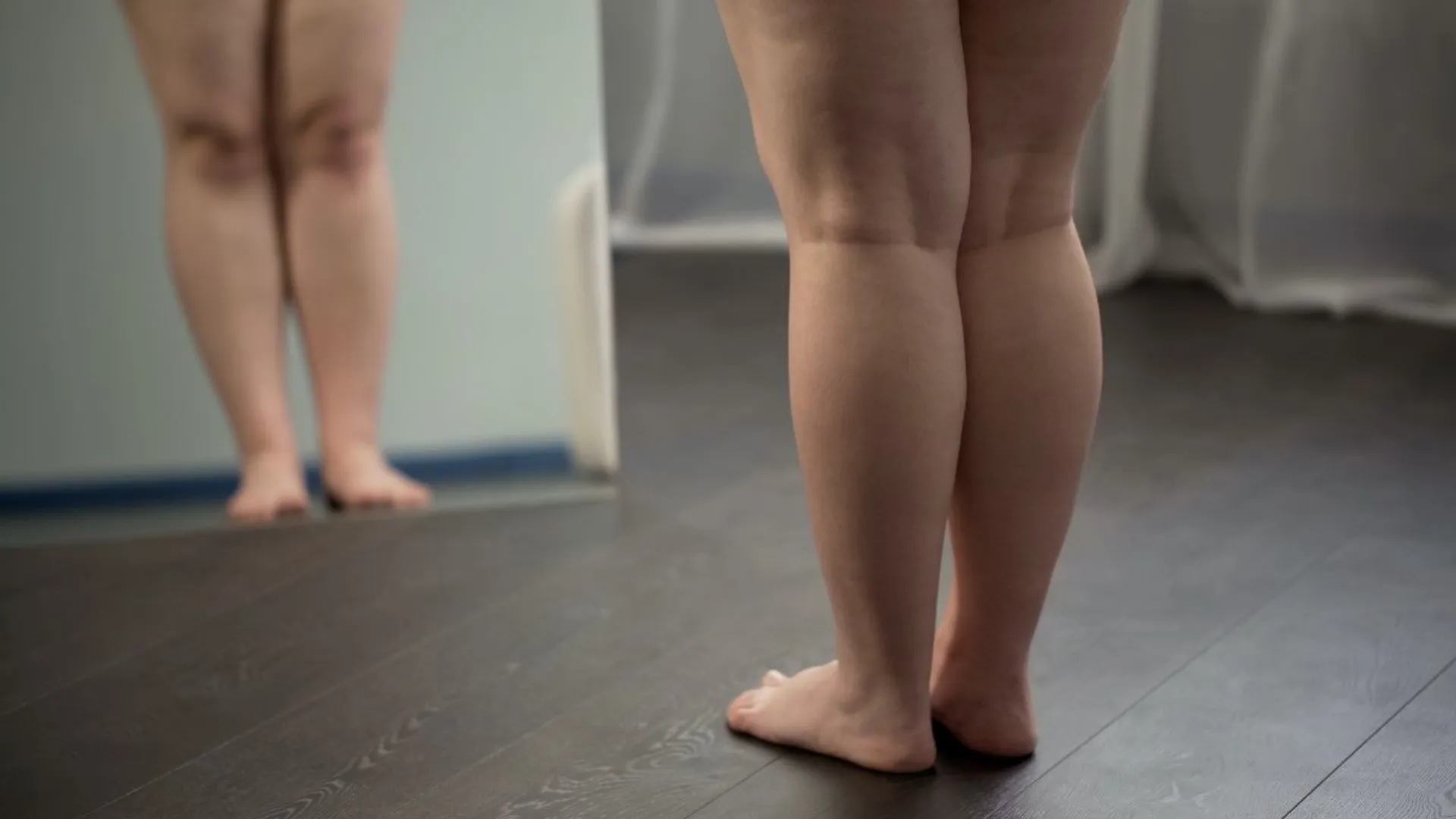 Kobieta z lipodemią patrzy w lustrze na swoje nogi
