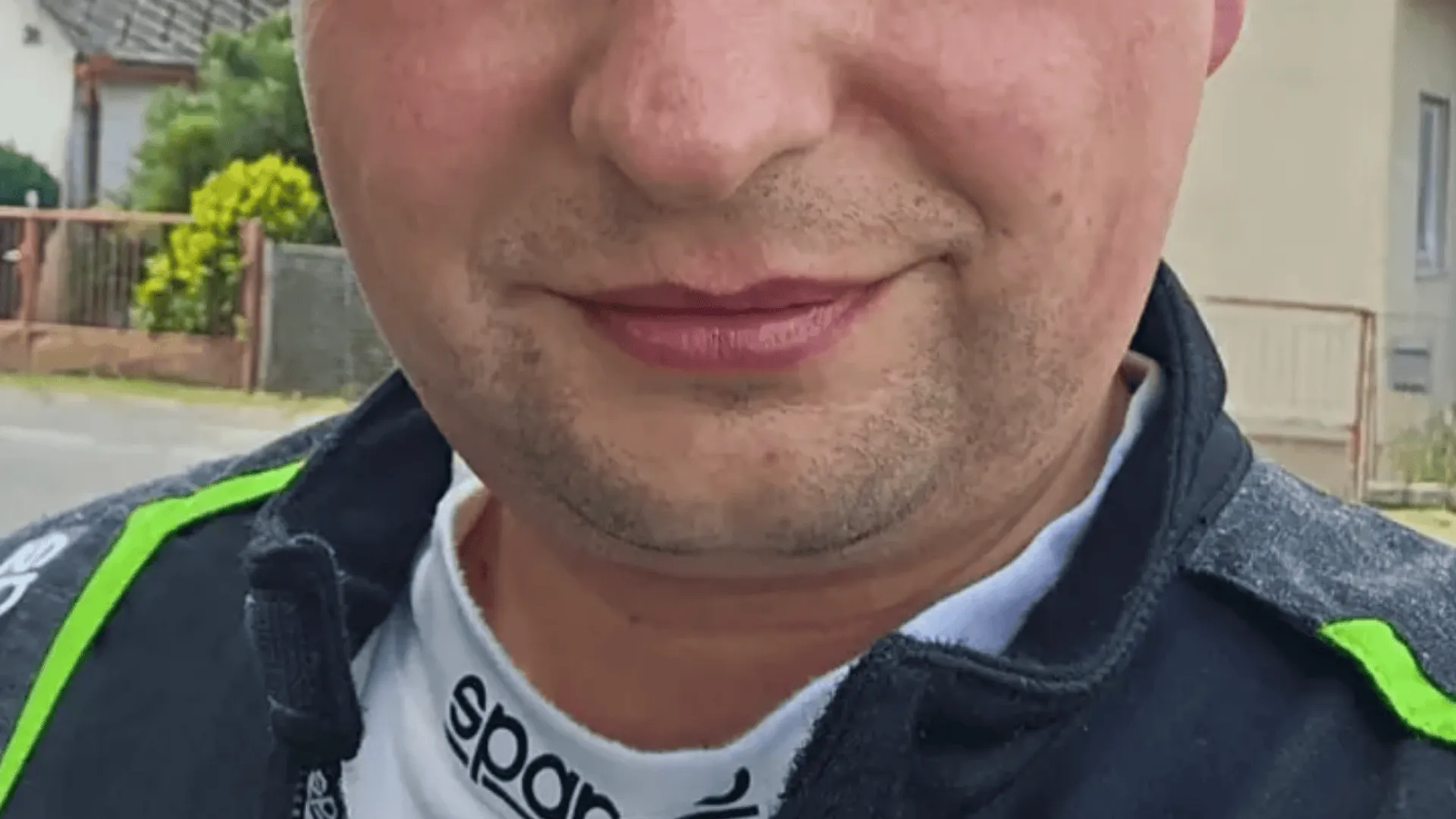 Polski mistrz kierownicy zginął na miejscu. Pilot doznał tragicznych obrażeń twarzy. Przerażające, jak teraz wygląda