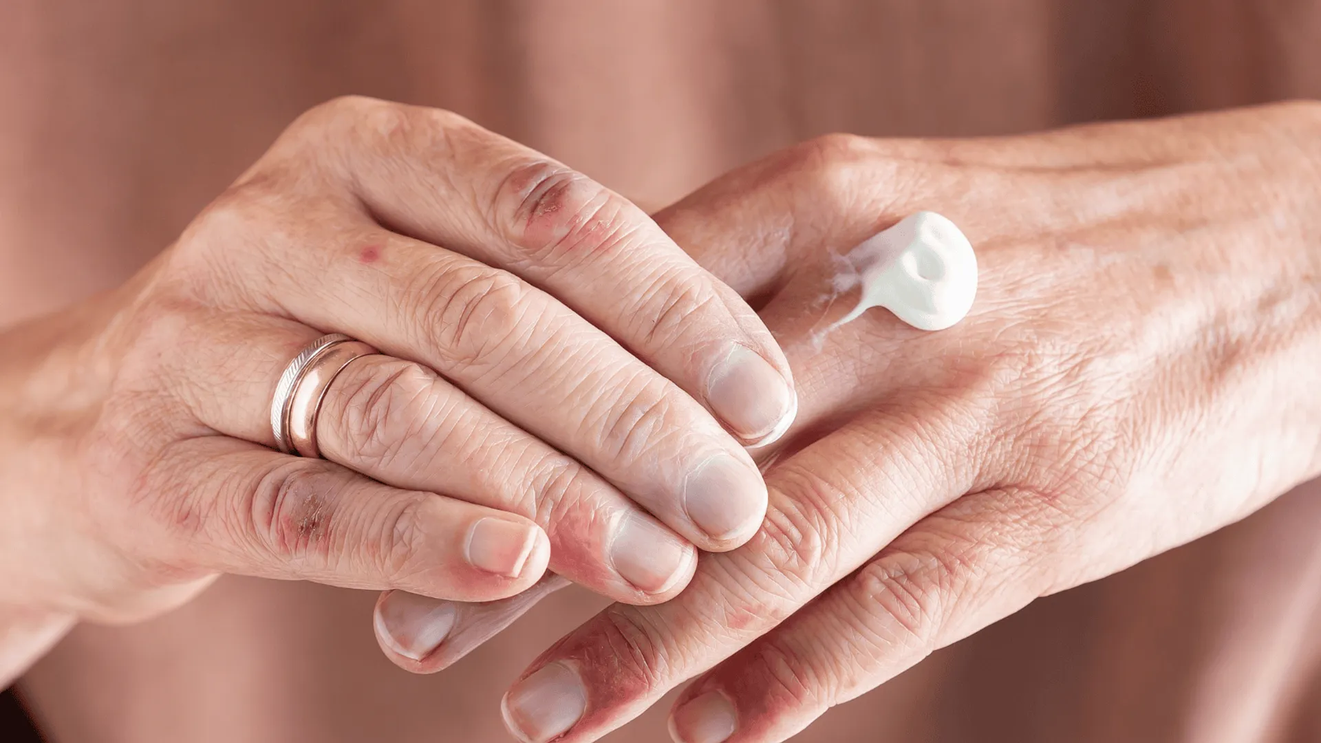 Maść na suche popękane dłonie