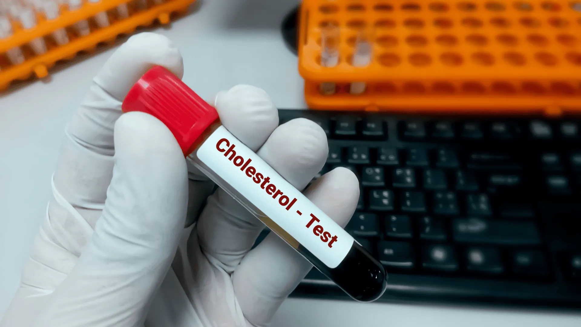 Nowe zalecenia dotyczące cholesterolu
