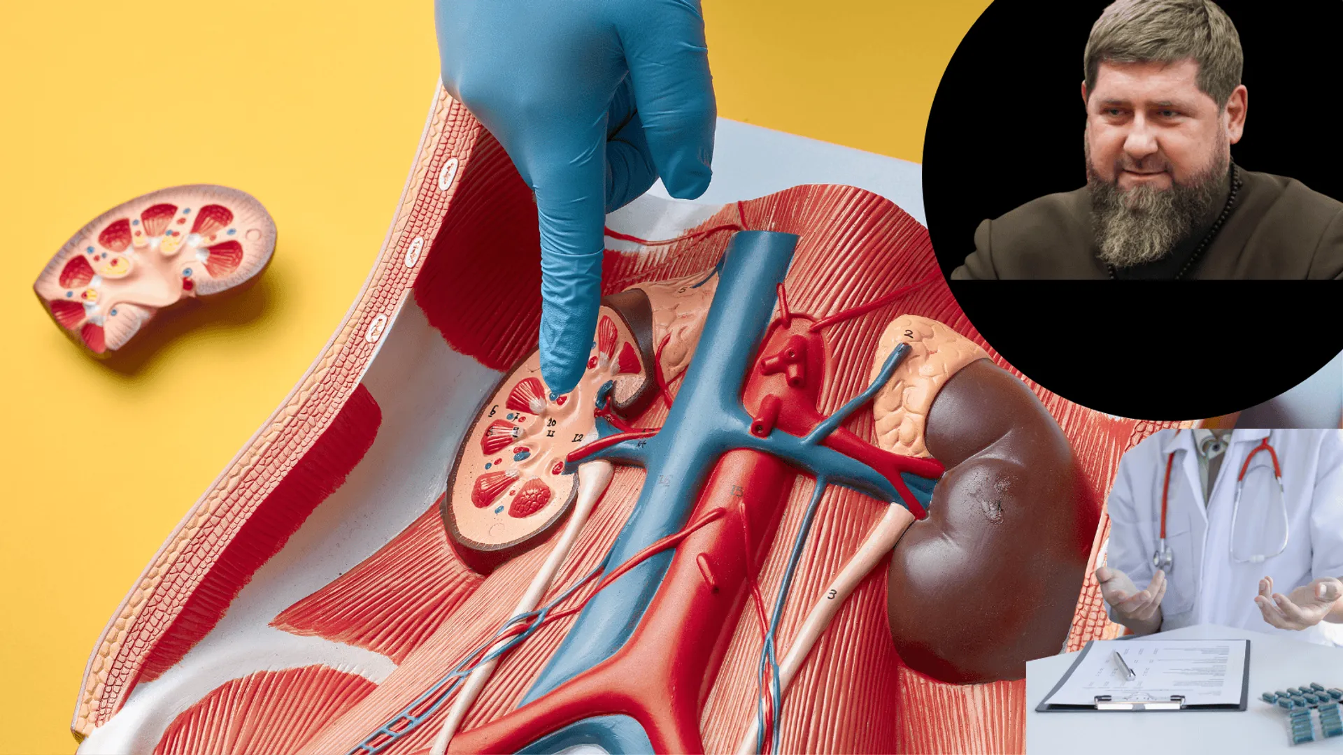 niewydolność nerek przywódcy