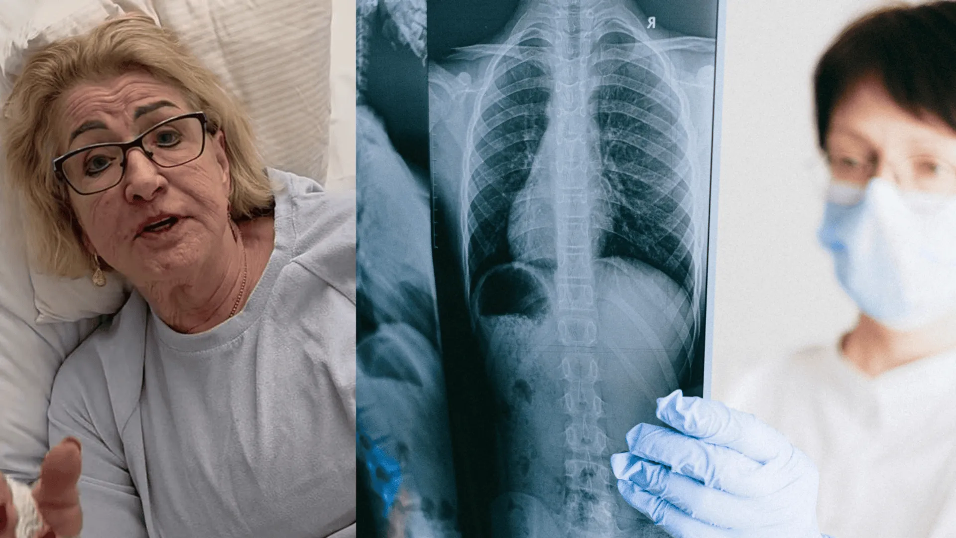 profilaktyka raka płuc, jak wykryć?