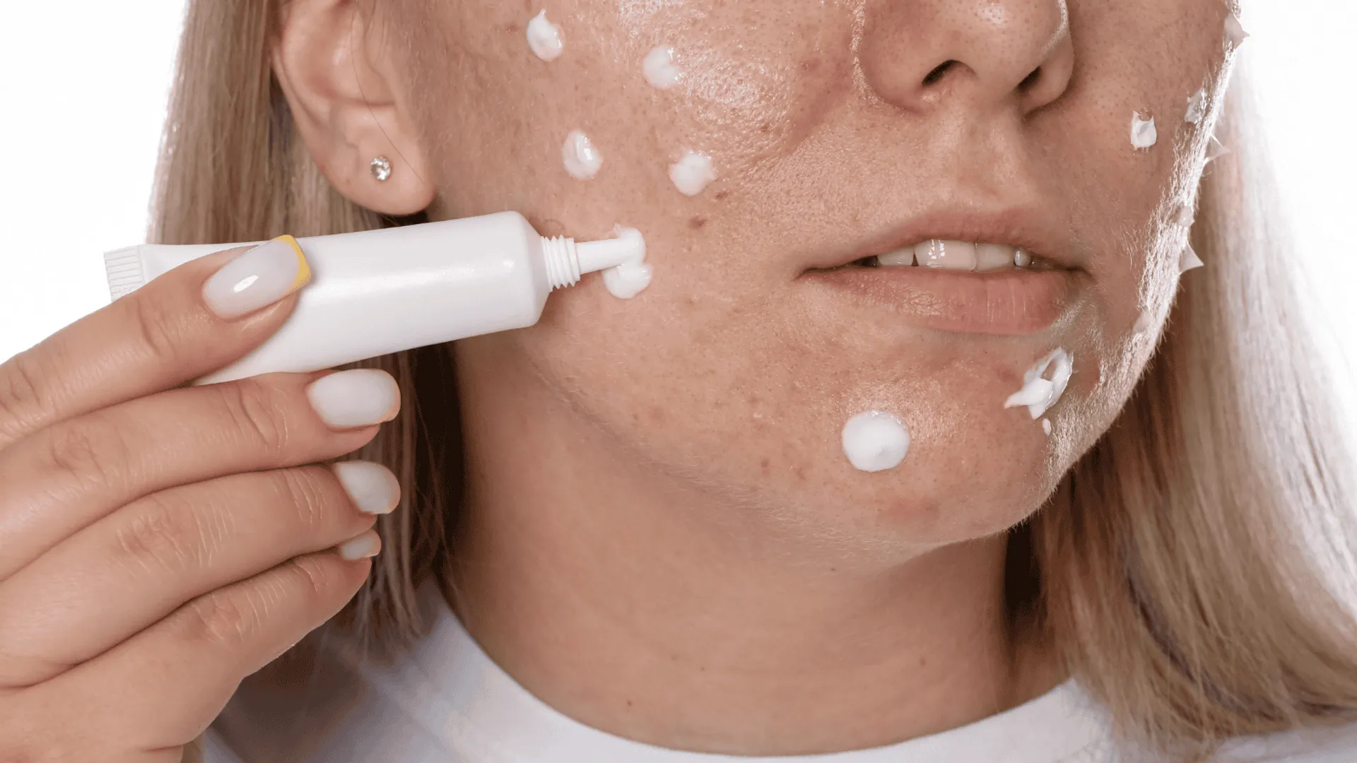 Pogromca plamek starczych z apteki