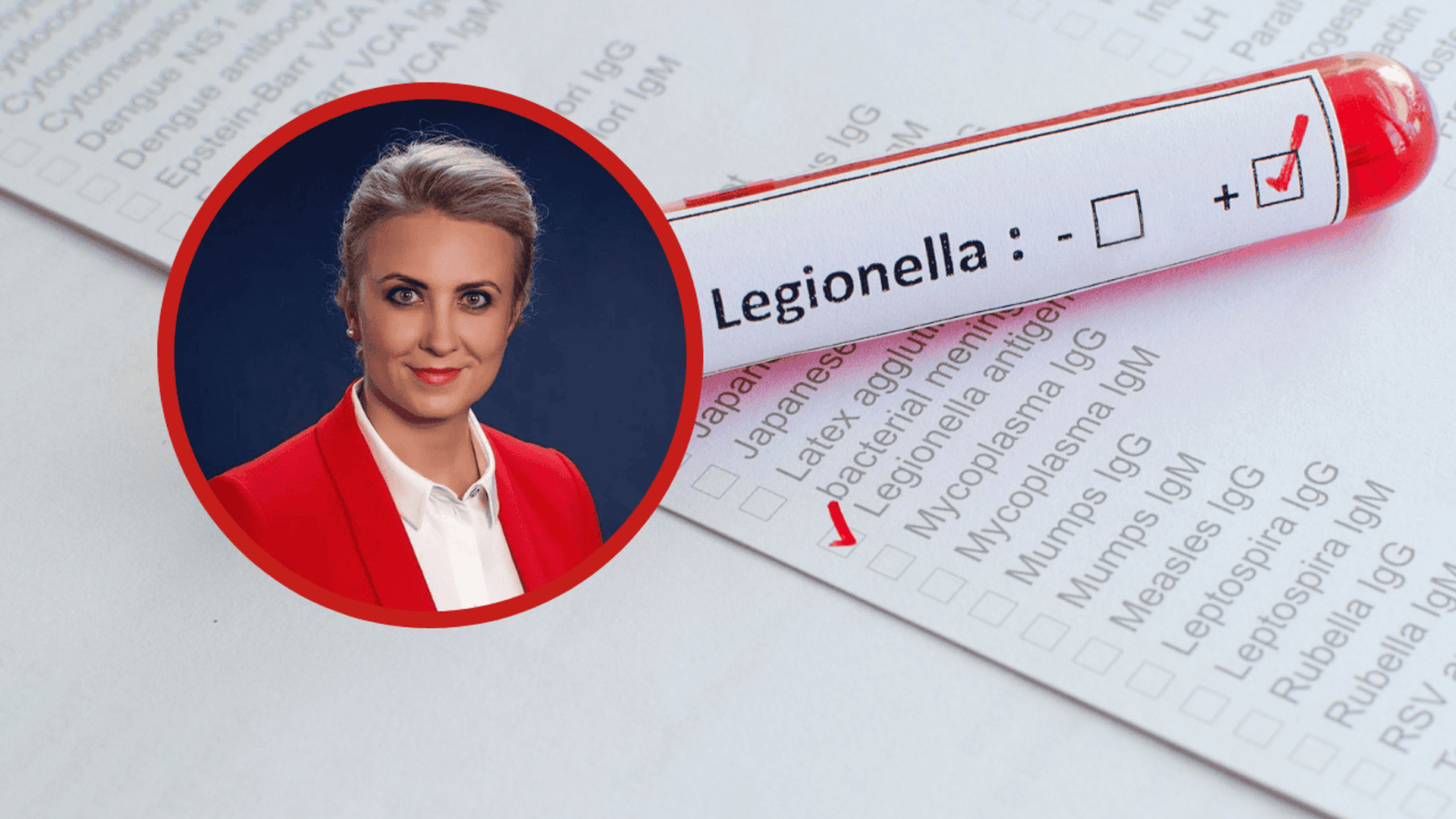 legionella