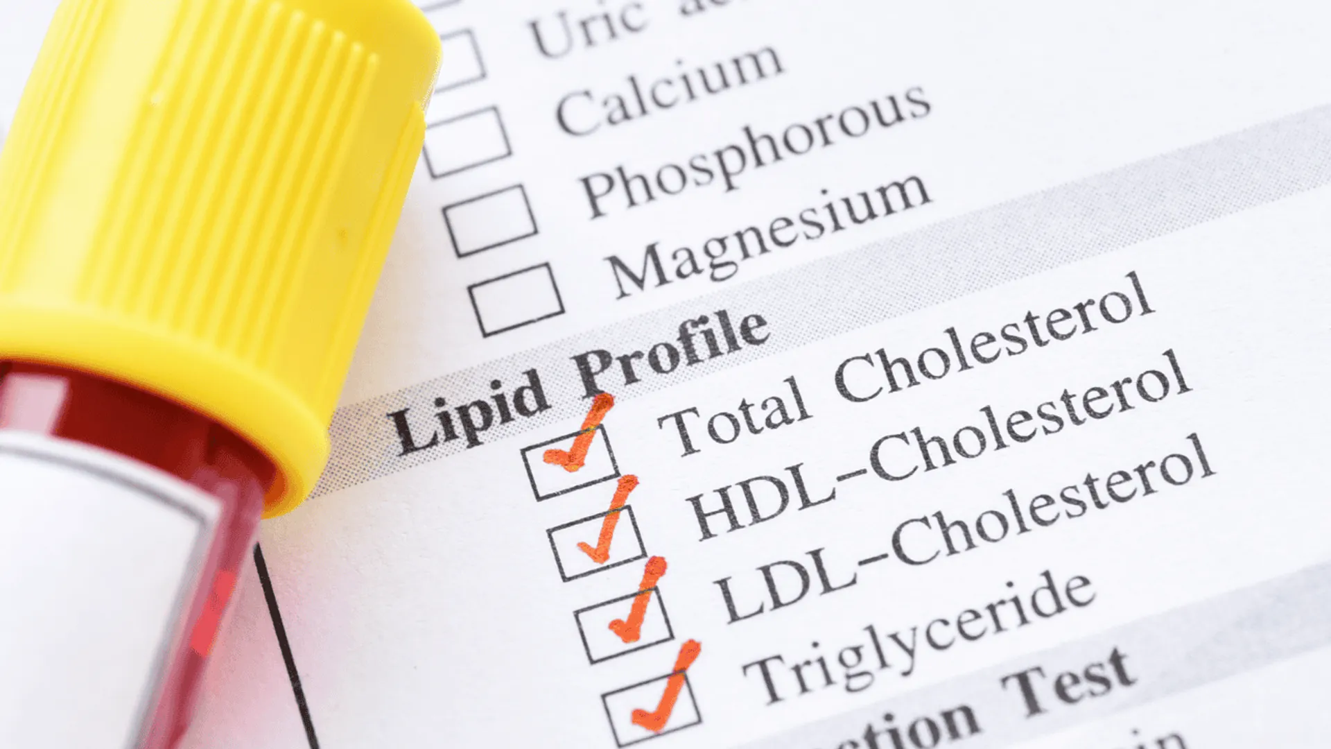 Jak rozpoznać wysoki cholesterol?