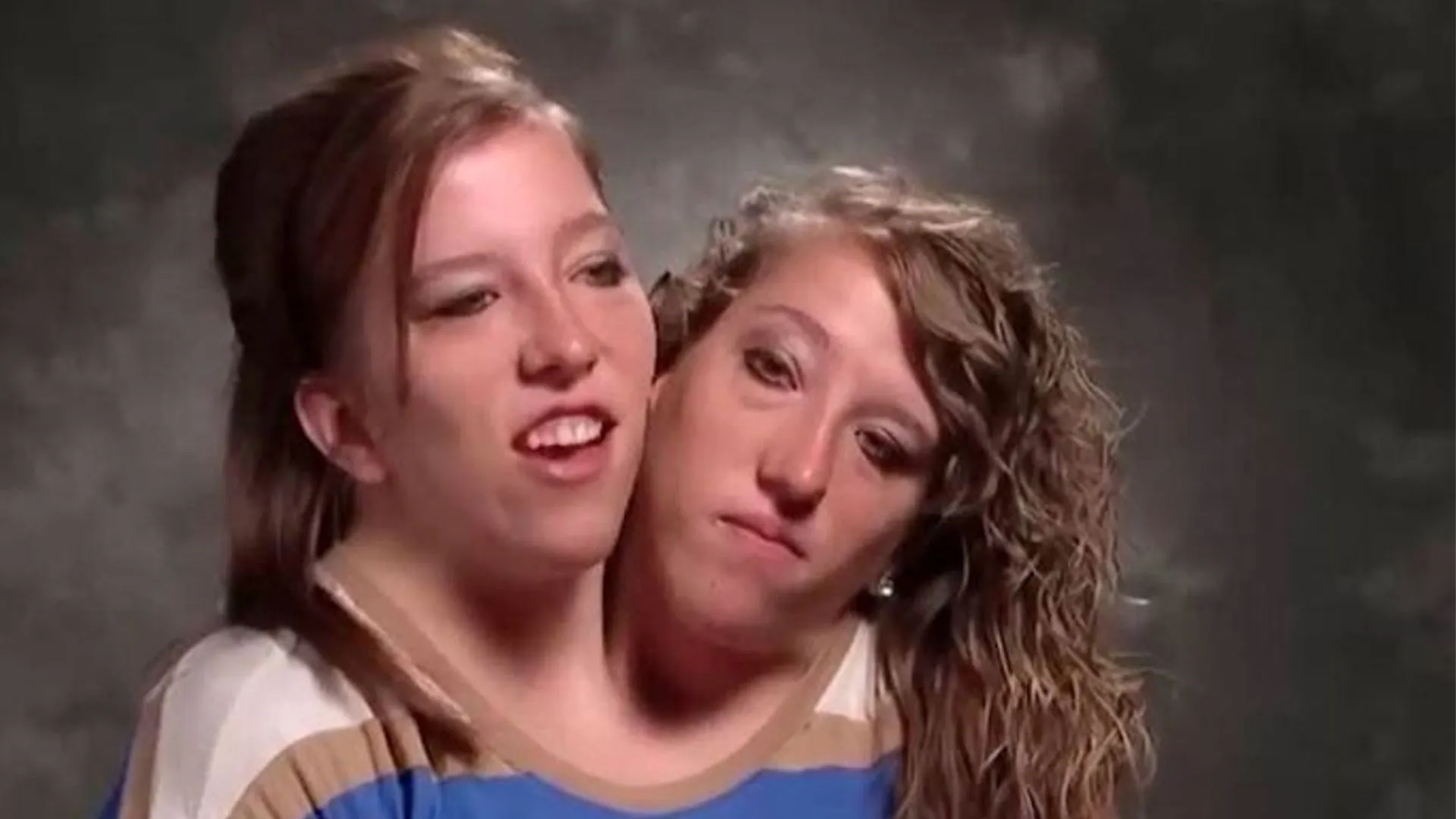 Abby i Brittany Hensel