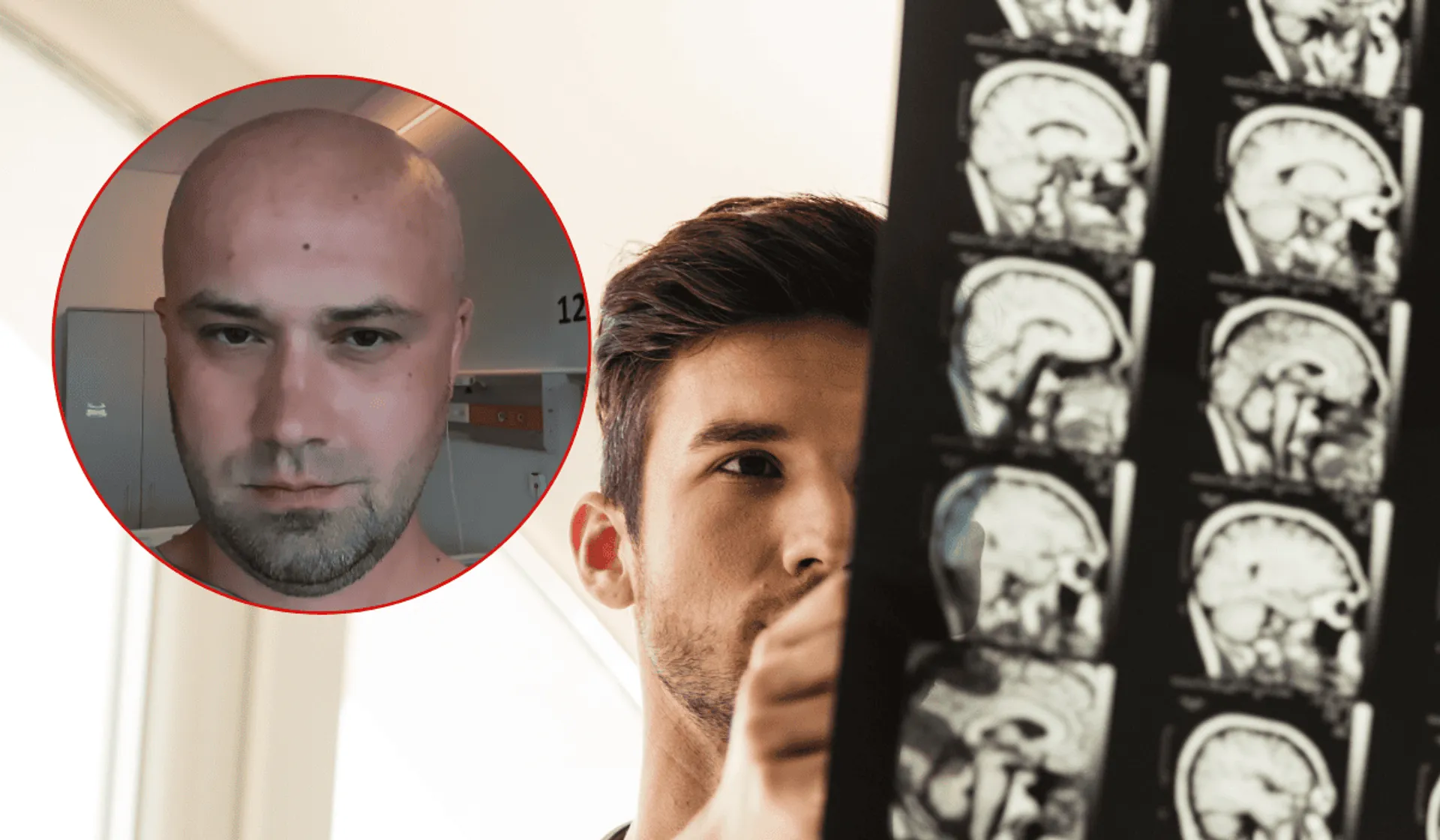 Adrian ze "ŚOPW" ma glejaka. Z łzami w oczach opowiada o chorobie