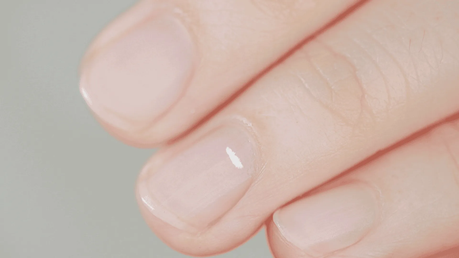 Niedobór tego pierwiastka zauważysz na paznokciach. Reaguj