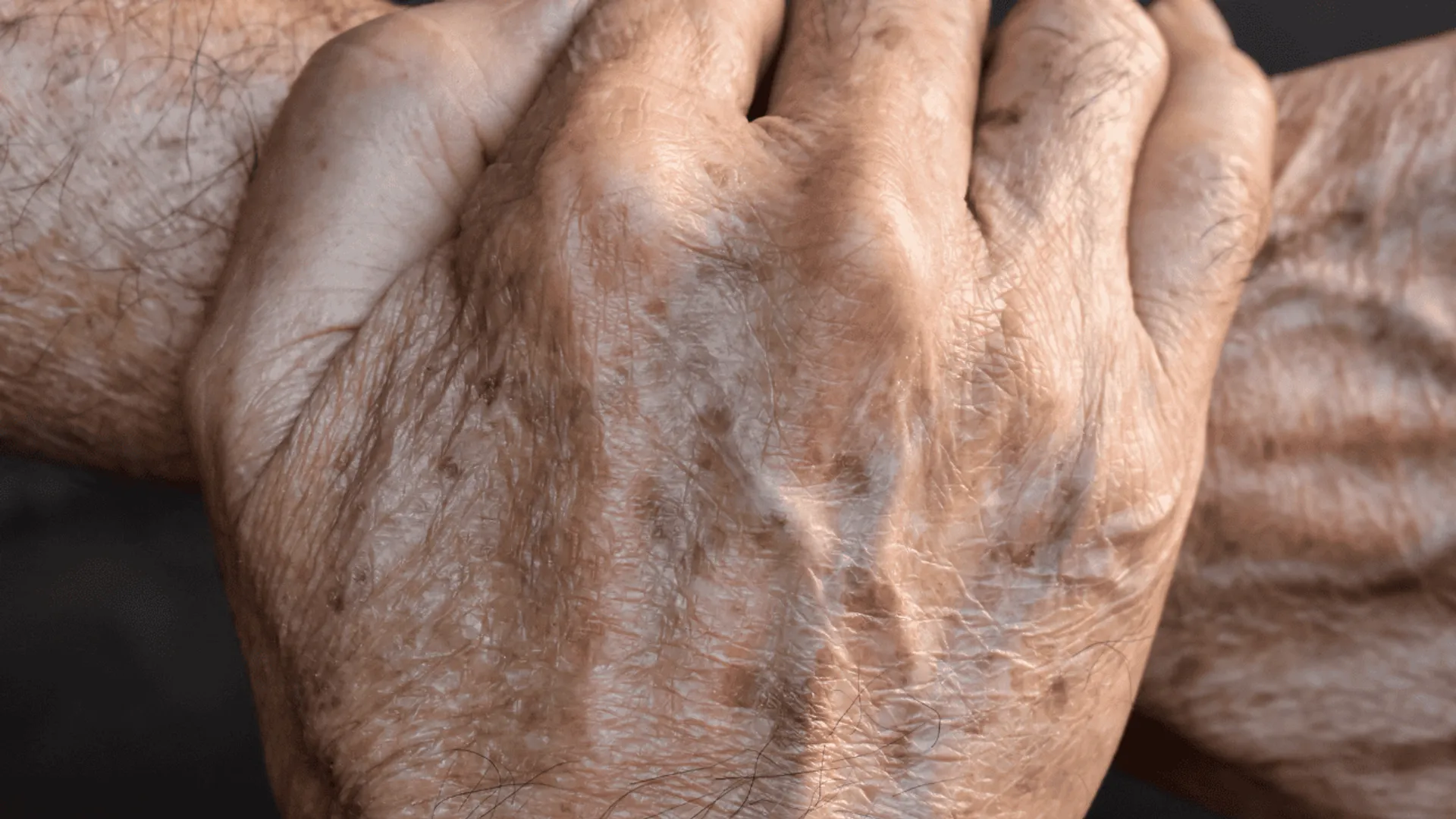 Krem do rąk a plamki starcze: jak działa i na co pomaga