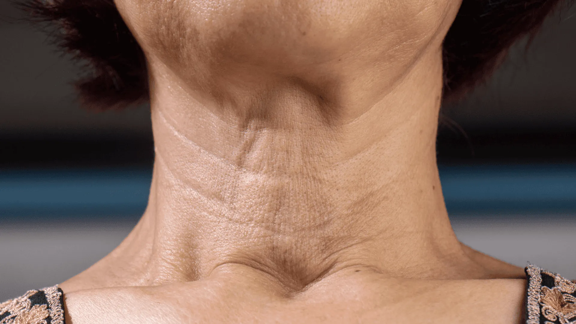 Grubość szyi a zdrowie. Kiedy obwód szyi wskazuje na poważne problemy?