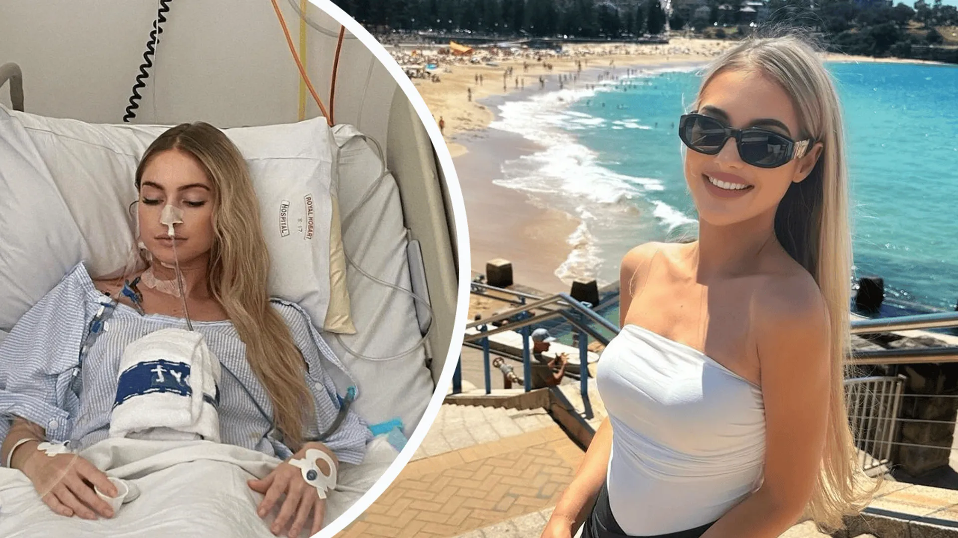 Tirah Ciampa, Miss Australia, modelka chora na raka