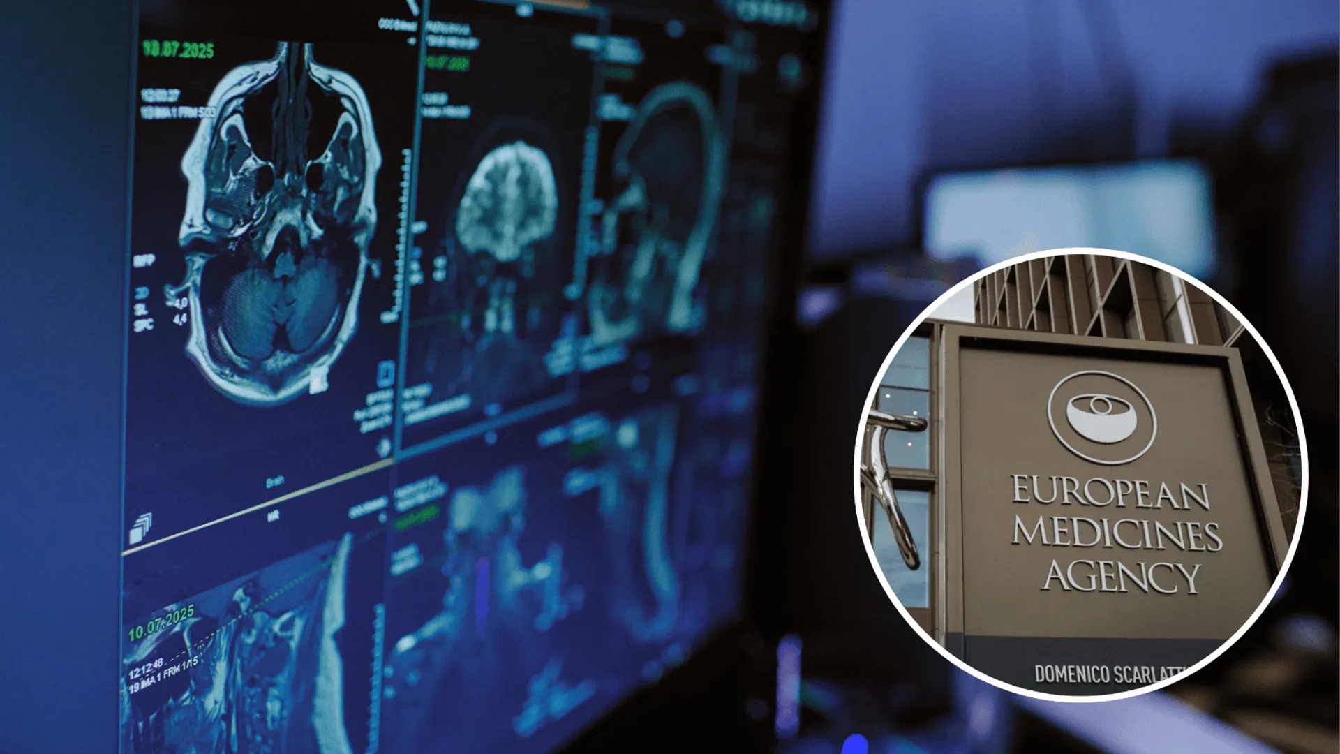 Wycofany lek uszkadza mózg