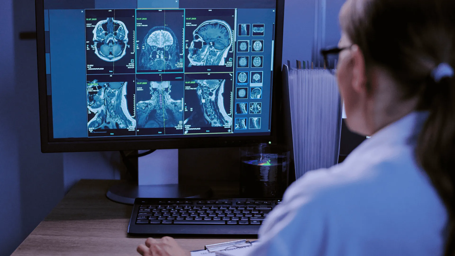 tomografia komputerowa