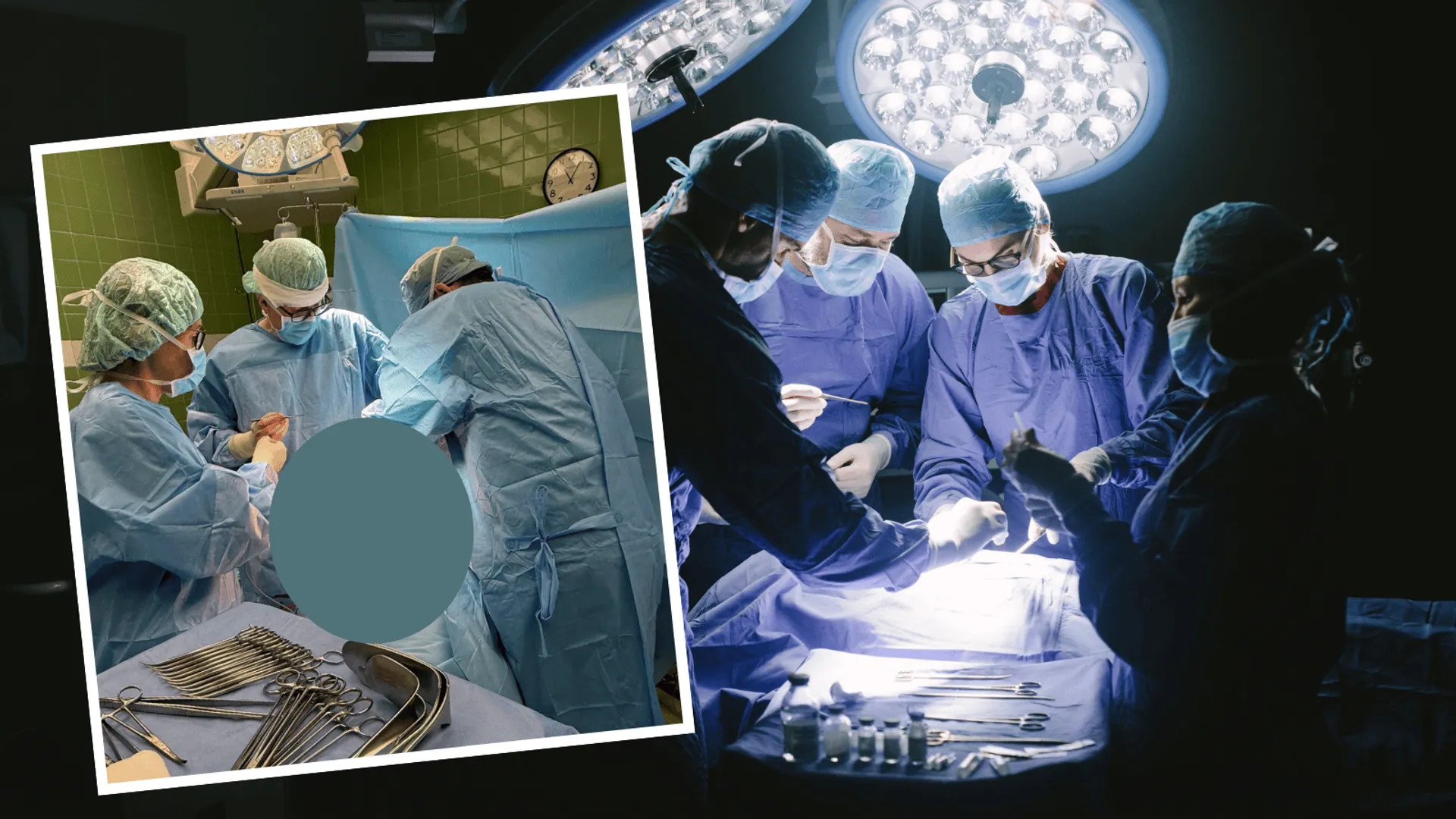 operacja mięsaka w Narodowym Instytucie Onkologii w Warszawie