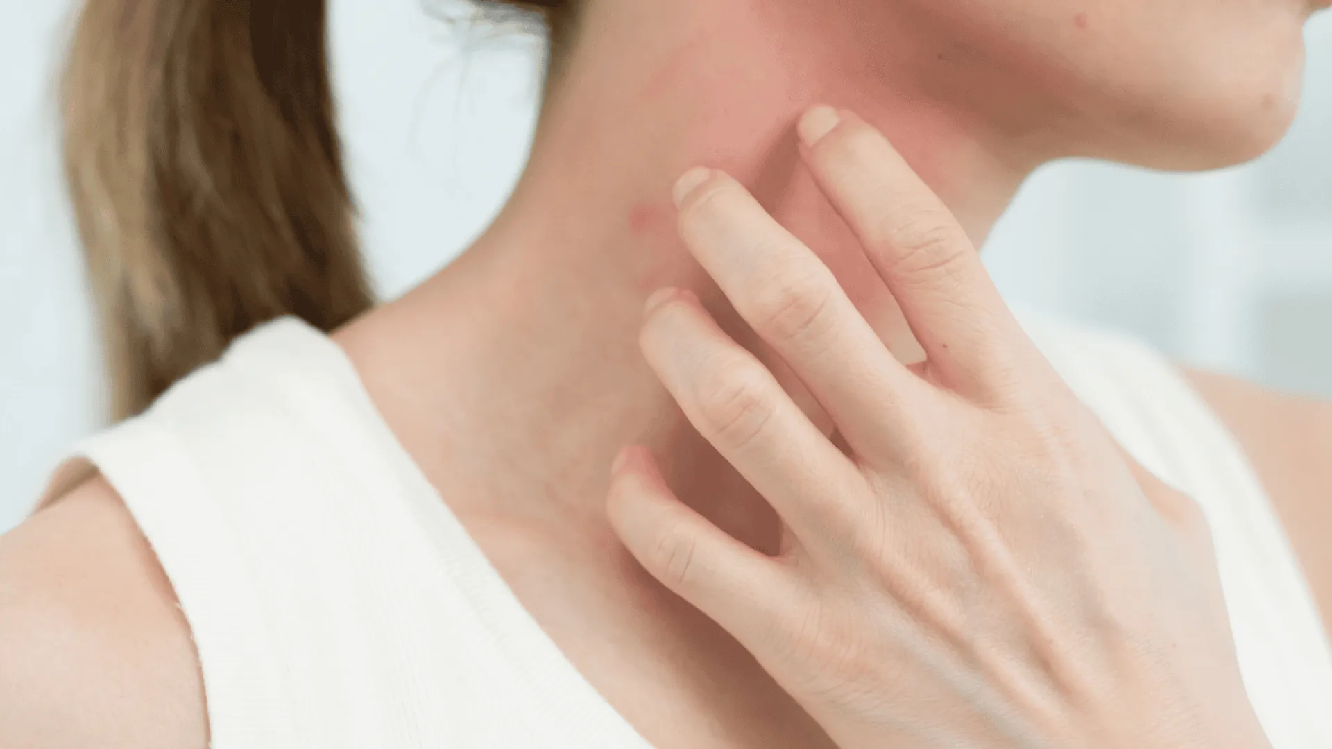 swędzenie skór/Fot. Canva/shisuka