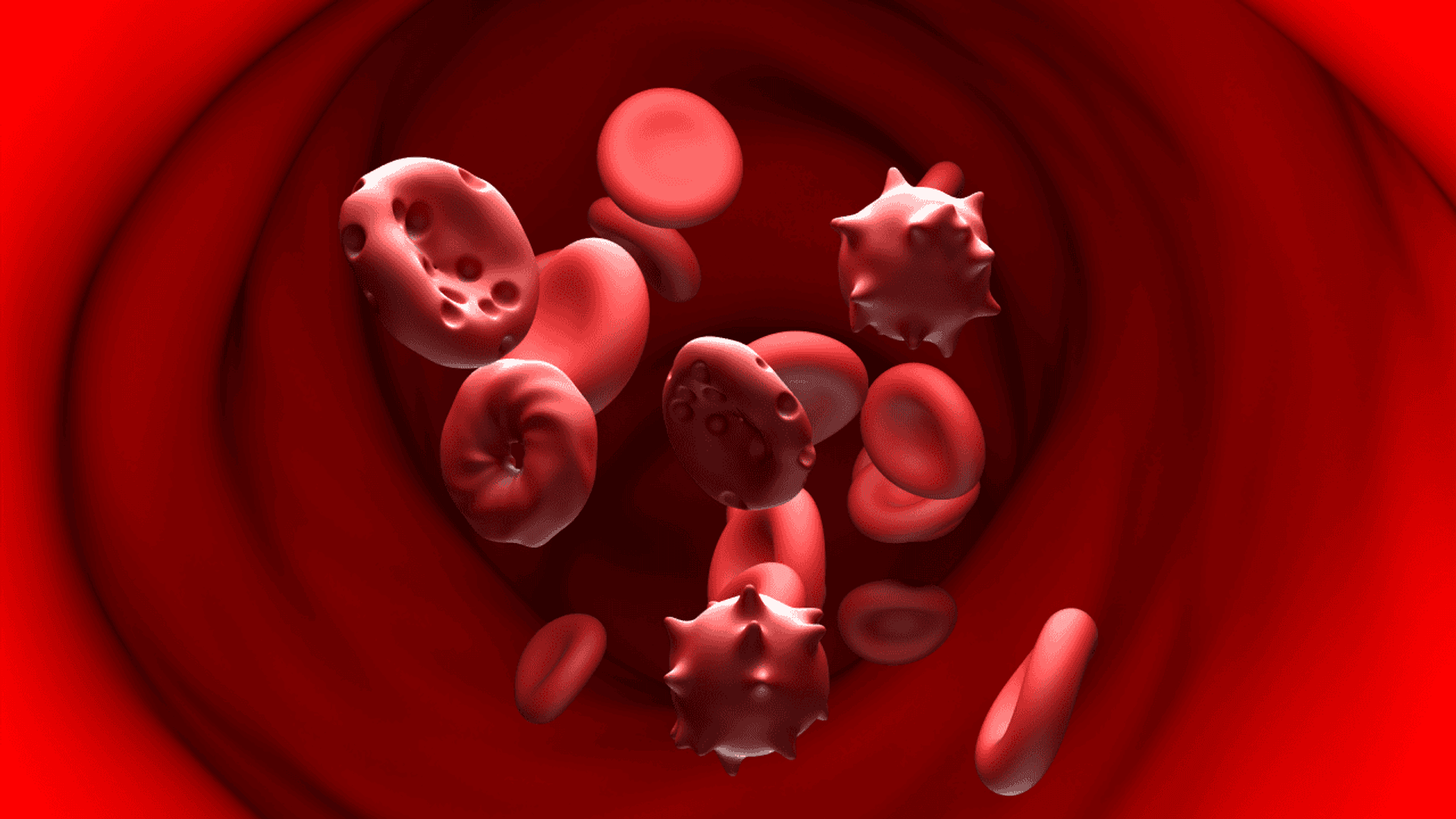 Anemia