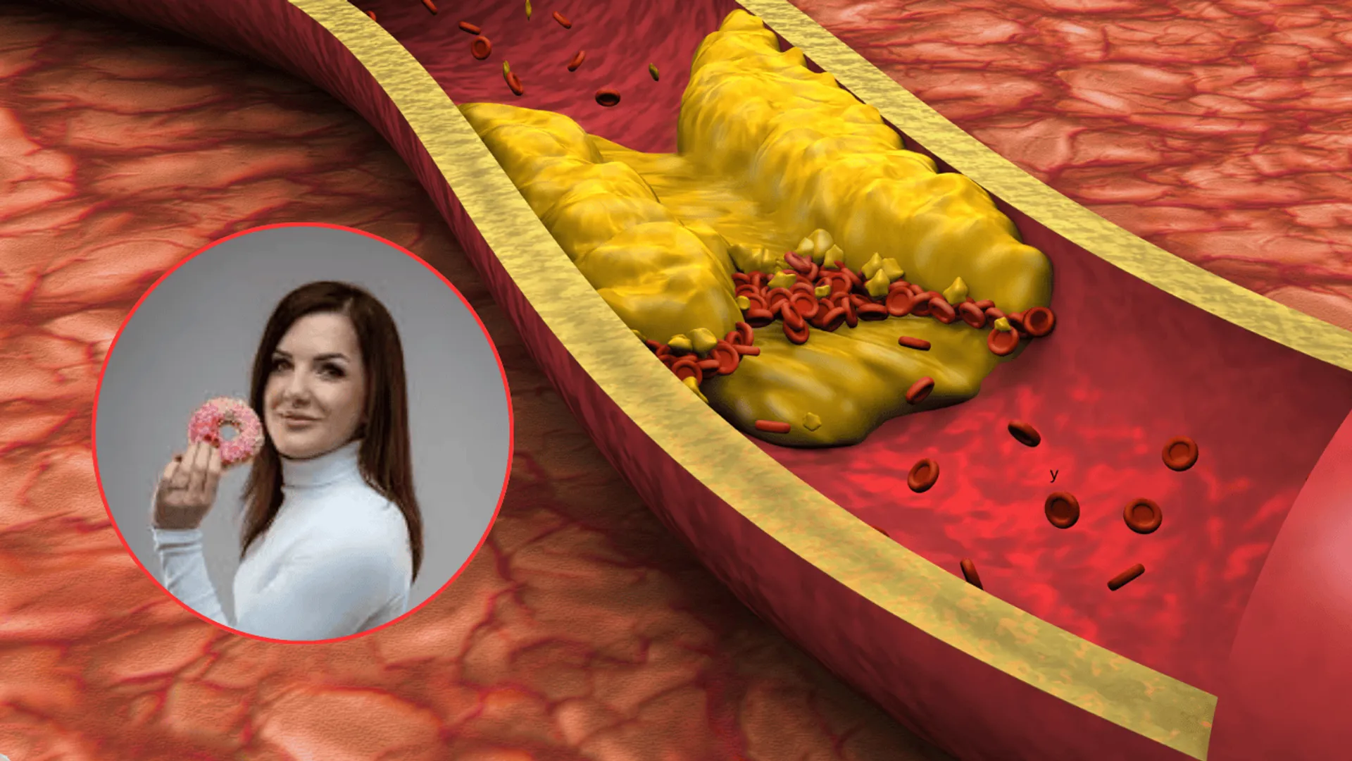 te produkty podbijają cholesterol