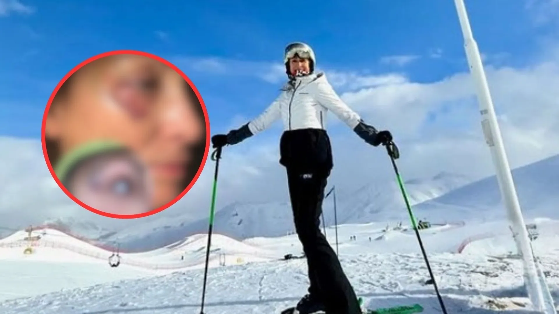 Dramatyczne chwile gwiazdy TVN. Doszło do groźnego wypadku