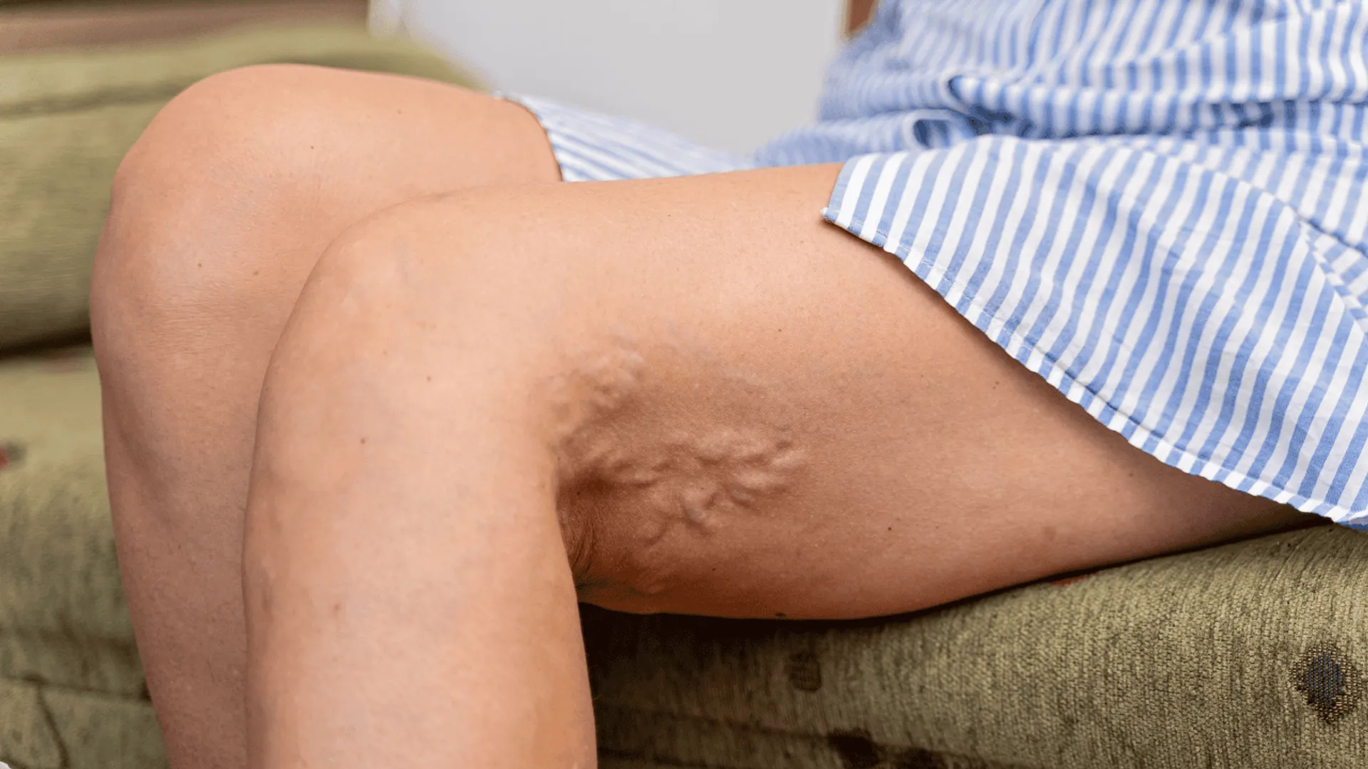 cholesterol - zatkane tętnice