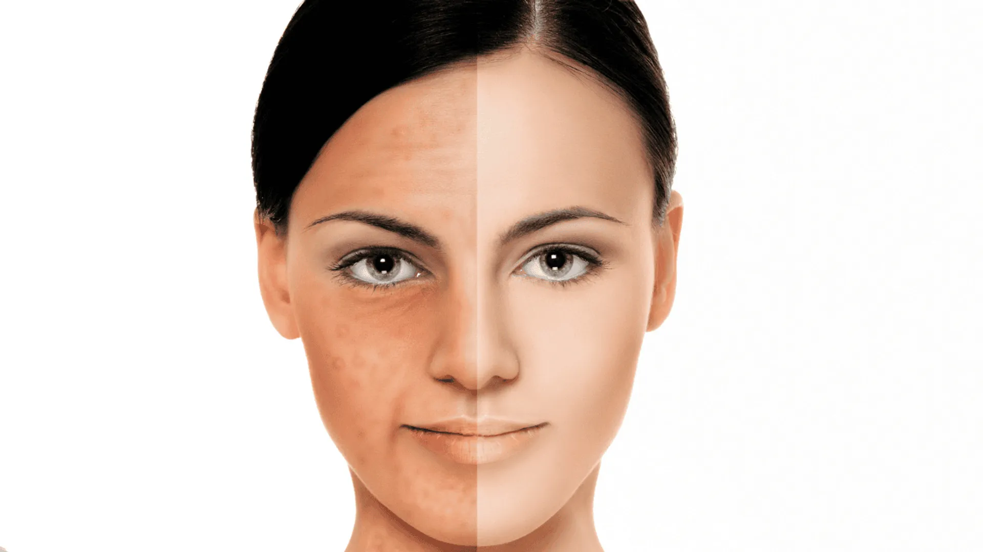 kosmetyki na przebarwienia