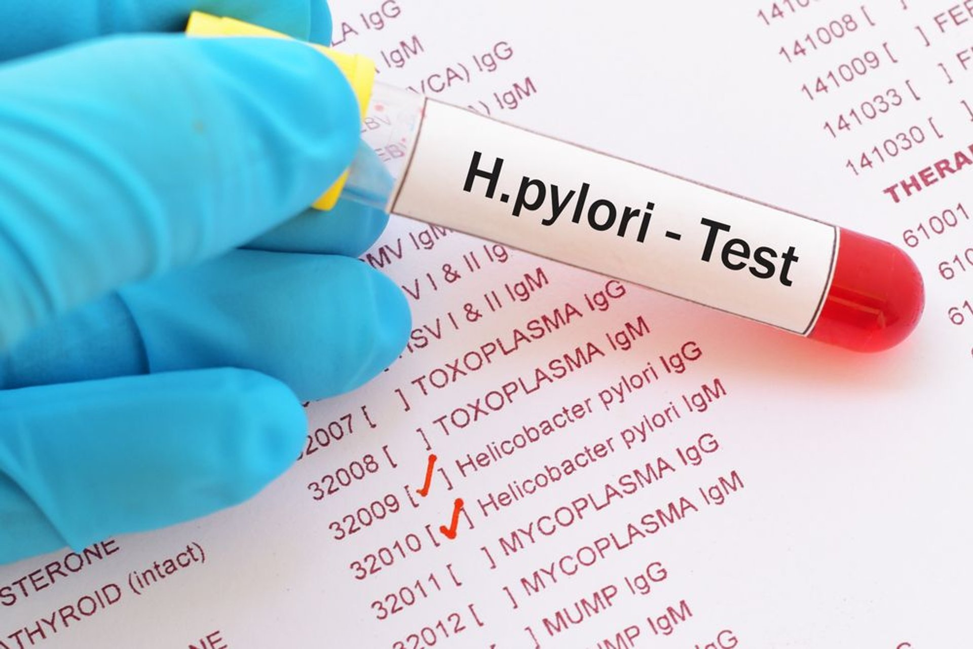 H.pylori test