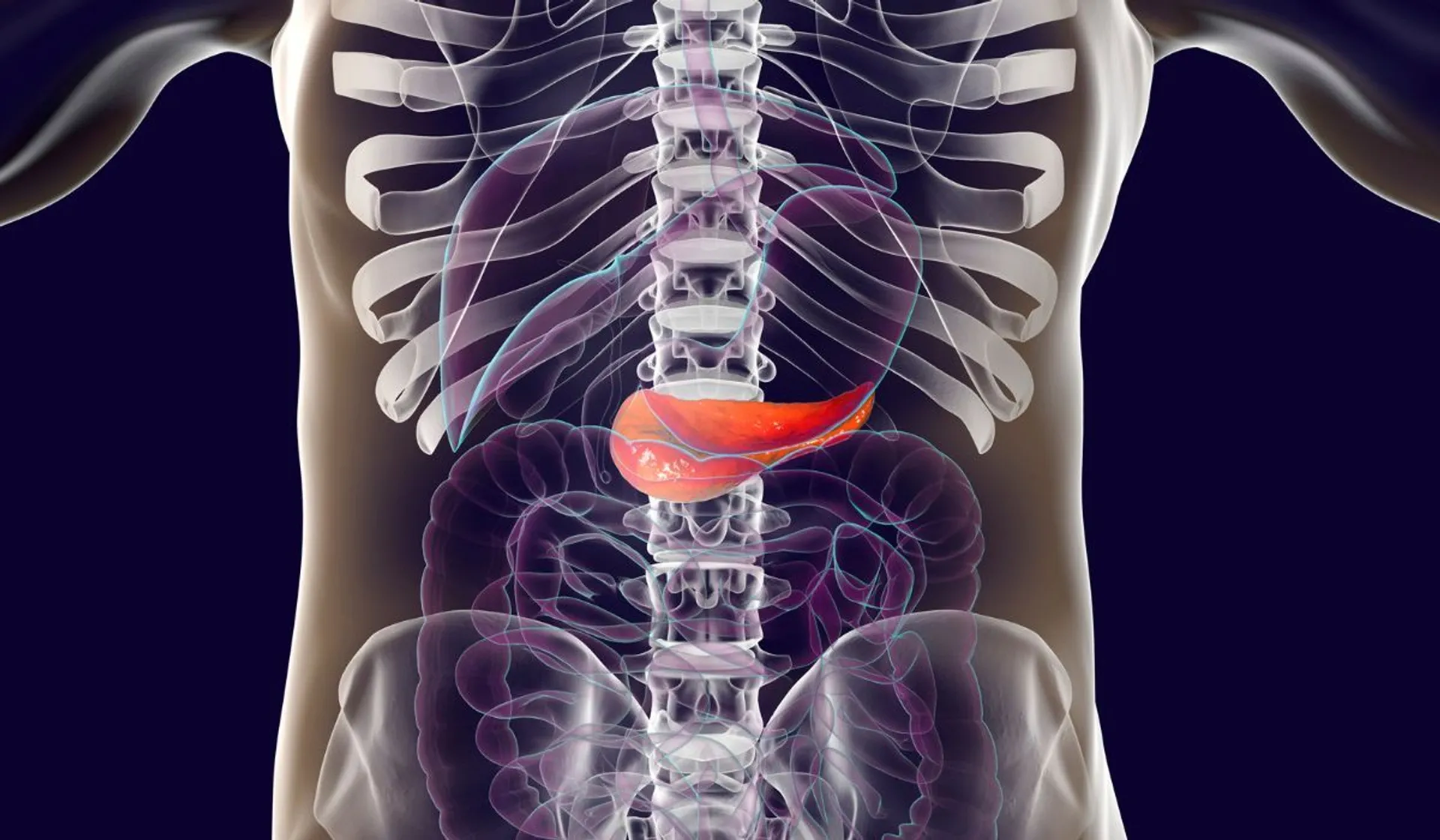 nietypowy objaw raka trzustki