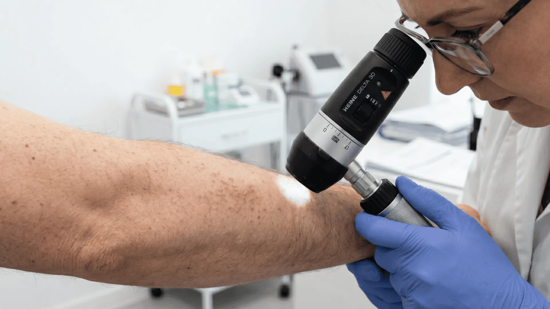 dermatolog bada wysypkę dermatoskopem
