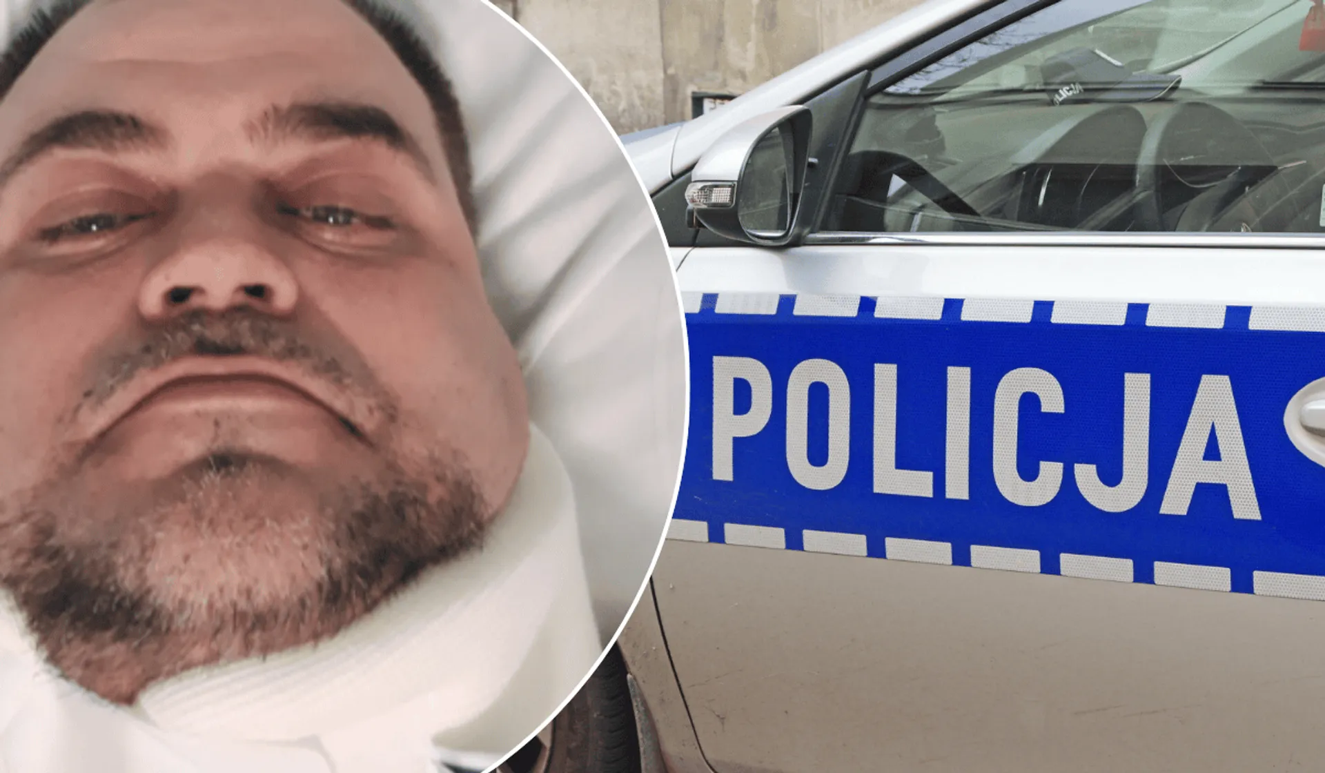 Krzysztof Czub po wypadku, radiowóz policji