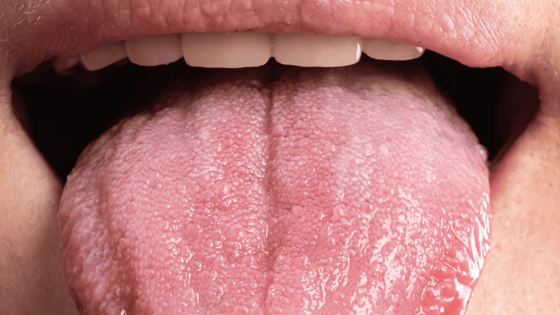 Język geograficzny – rozpoznanie, powiązania zdrowotne i metody łagodzenia