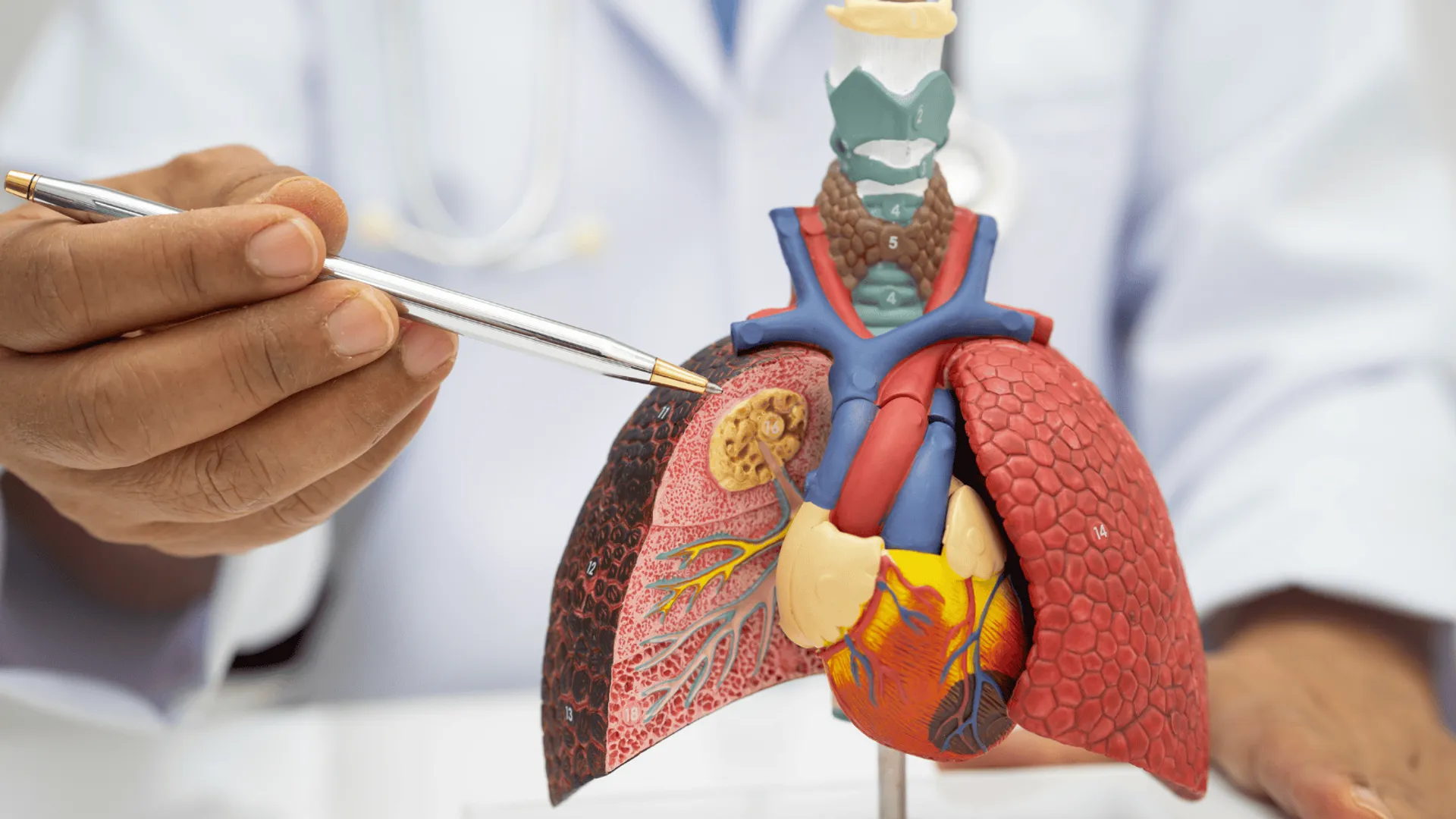 Rak płuca – statystyki, objawy i kluczowa rola profilaktyki