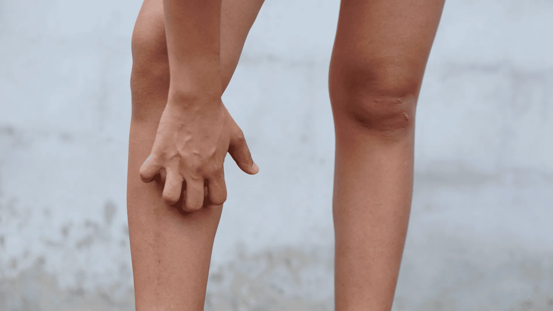 Swędzące nogi jako sygnał chorób wewnętrznych