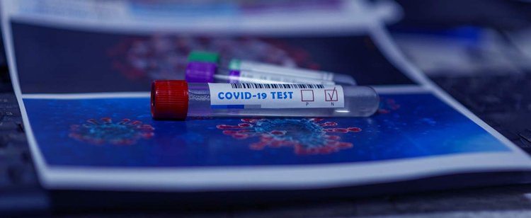 Kto może zostać skierowany na test na koronawirusa? Objaśniamy najnowsze wytyczne