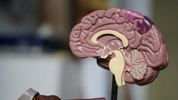 Problemy Neuralink. Interfejs mózg-maszyna traci elektrody
