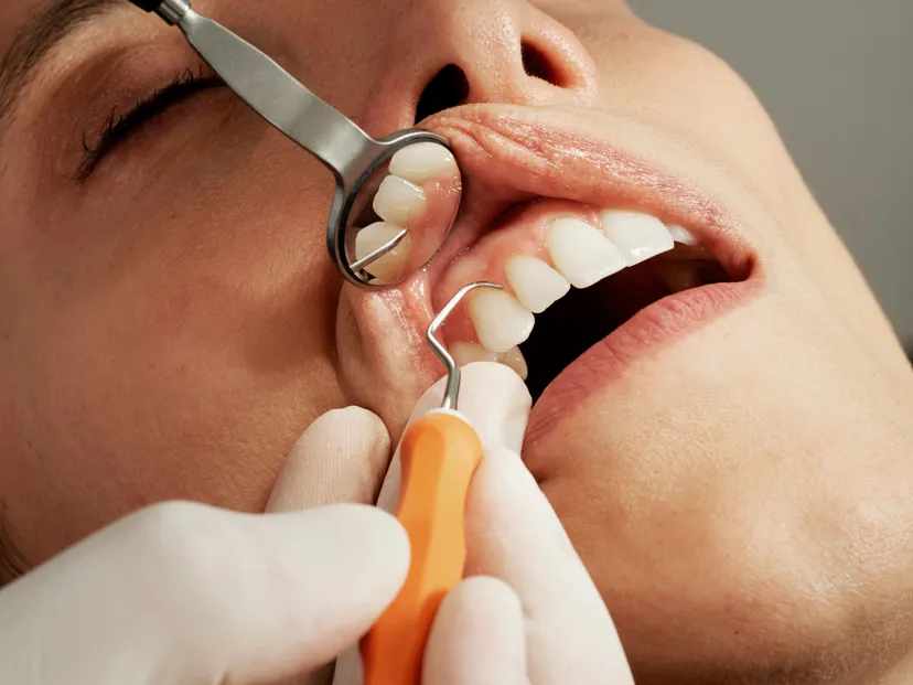 Ceny u dentystów mocno w górę. Najnowsze dane niepokoją