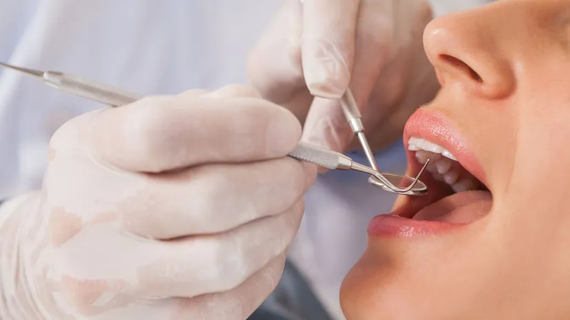 Ceny u dentystów w 2026 szokują. W tych miastach zapłacisz krocie, pacjenci rezygnują z leczenia