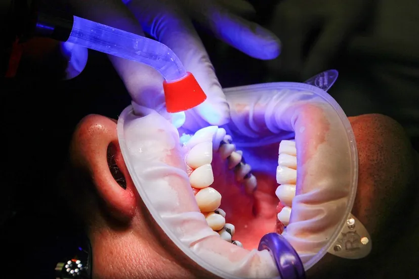 Wizyta u dentysty za "grosze". To tam Polacy jeżdżą leczyć zęby. MSZ jednak ostrzega