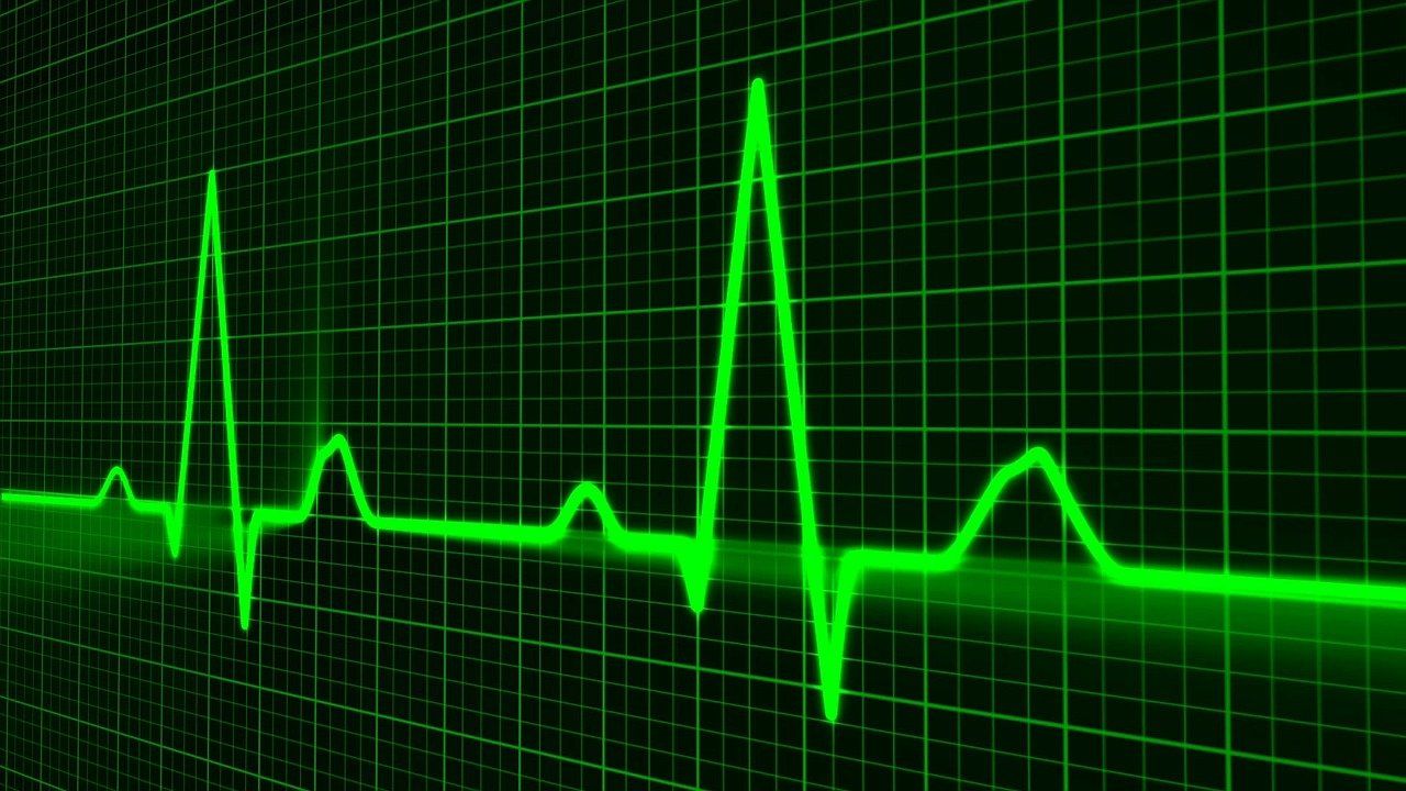 EKG – jak wygląda badanie serca oraz jakie są jego wady i zalety?