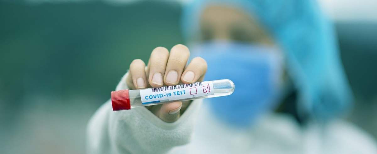 Test na koronawirusa w Holandii