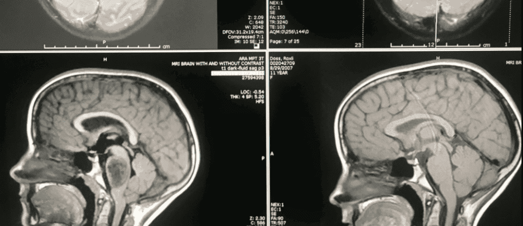 Badanie MRI