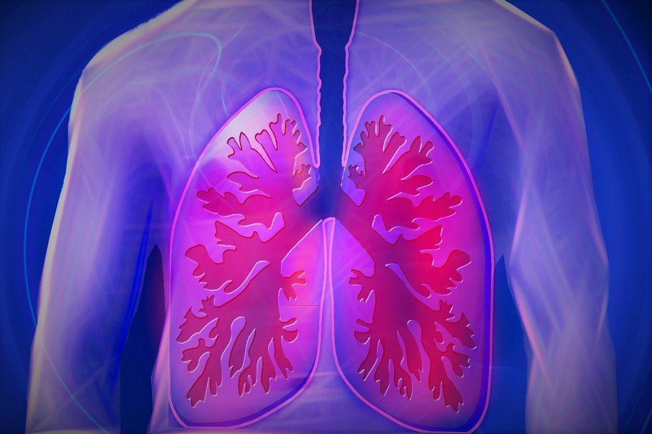 Popierwotna gruźlica płuc – przyczyny, objawy, leczenie