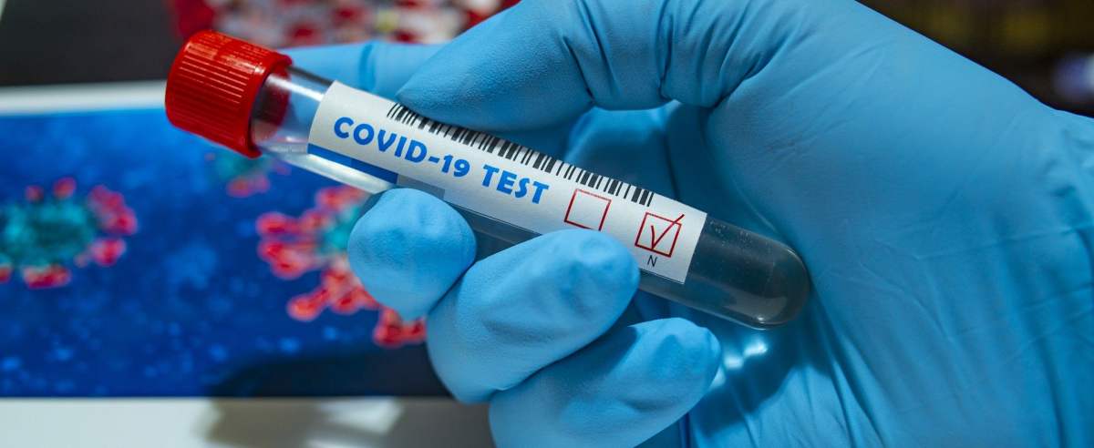 Ile kosztuje test na koronawirusa?