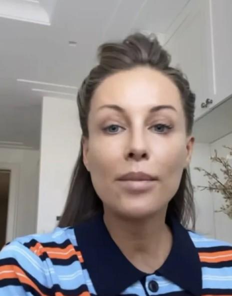 Małgorzata Rozenek-Majdan bez makijażu. Jak naprawdę wygląda cera gwiazdy z bliska? 