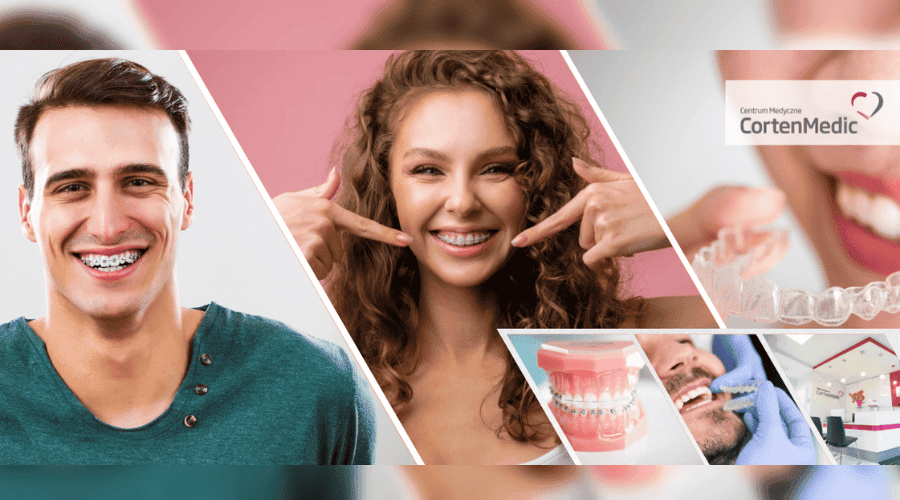 Jaki aparat ortodontyczny jest dla ciebie?