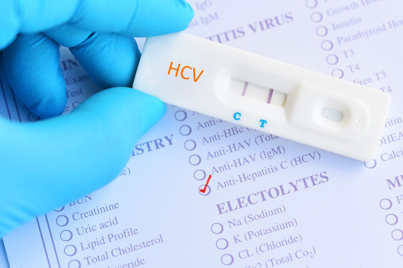 Anty-HCV – kto i kiedy powinien wykonać badanie na obecność przeciwciał przeciw wirusowi WZW typu C